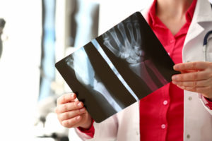 Female radiologist hold in hand xray film